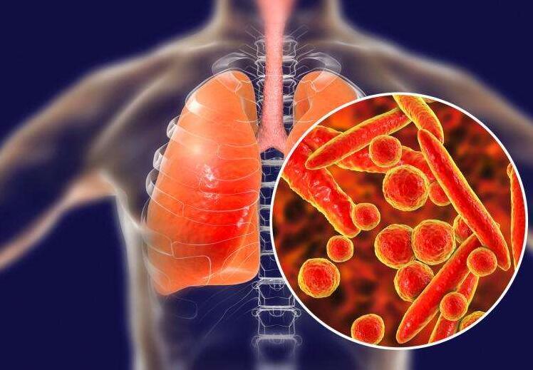 中国保健协会关于防控新型冠状病毒肺炎的保健提议