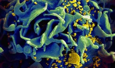 急性抗病毒疗法有助于缩小HIV储藏库