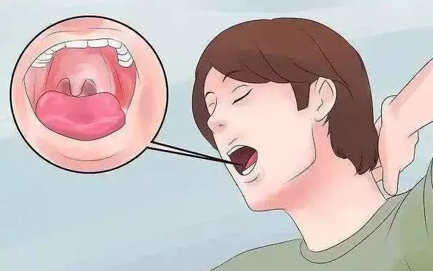 夜磨牙、舌根发干是怎么回事？