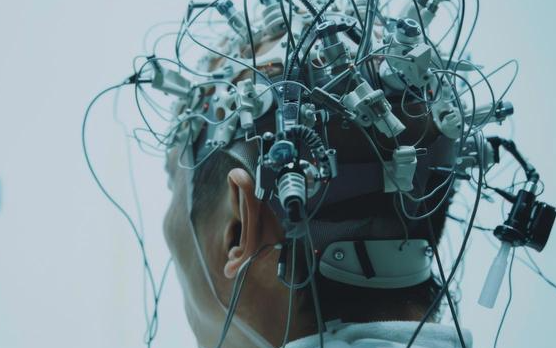 重大突破！中国抢在马斯克前，全球首个脑机接口医疗器械获批上市