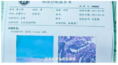 款国产“抗癌神药”纳入医保，可治疗多种癌症